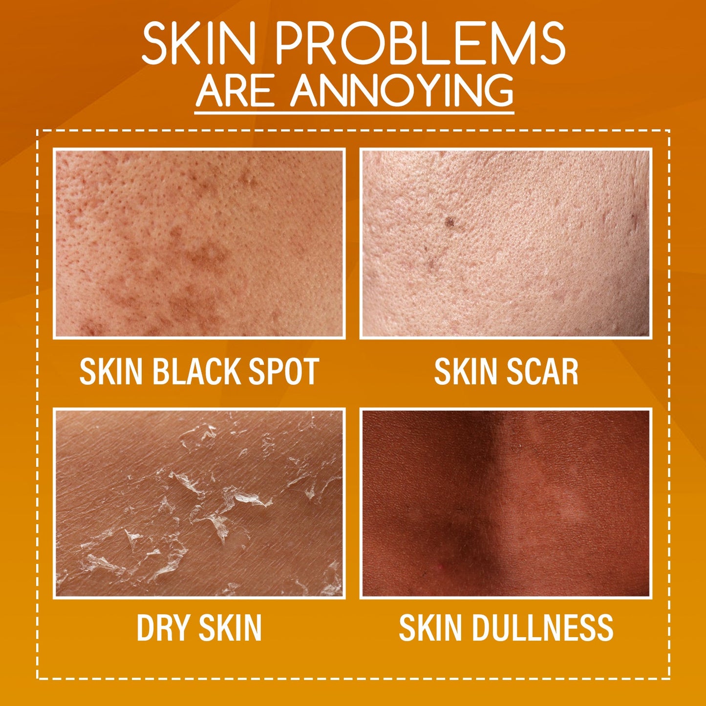OUHOE Orange Peel Body Lotion, Exfoliation Lightening Dark Spots Brightening And Moisturizing Skin Treatment Lotion eprolo