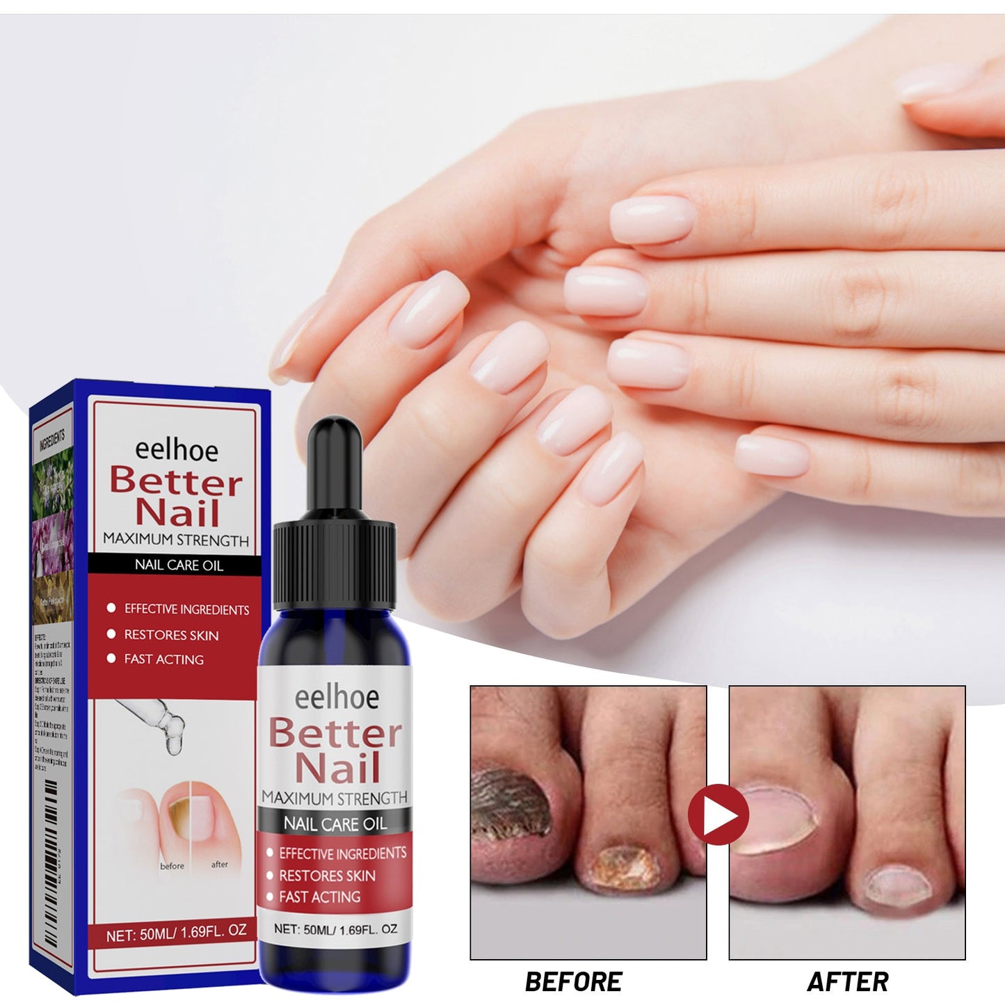 EELHOE Nail Repair Solution, Hands And Feet Nail Repair Moisturizing Clean And Remove Gray Nail Repair Solution eprolo