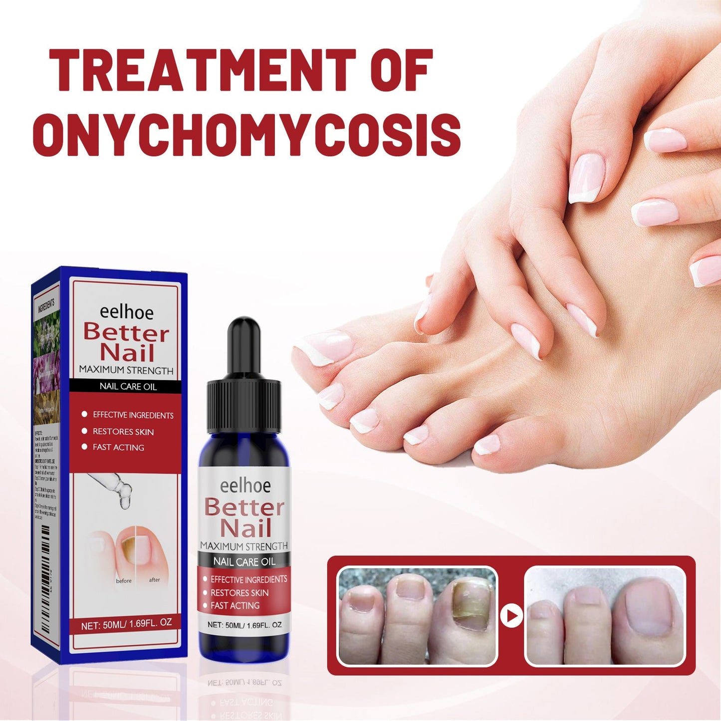 EELHOE Nail Repair Solution, Hands And Feet Nail Repair Moisturizing Clean And Remove Gray Nail Repair Solution eprolo